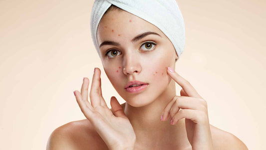 Acne Skin Problems: Tips to Get Rid of Acne and Achieve Clear Skin