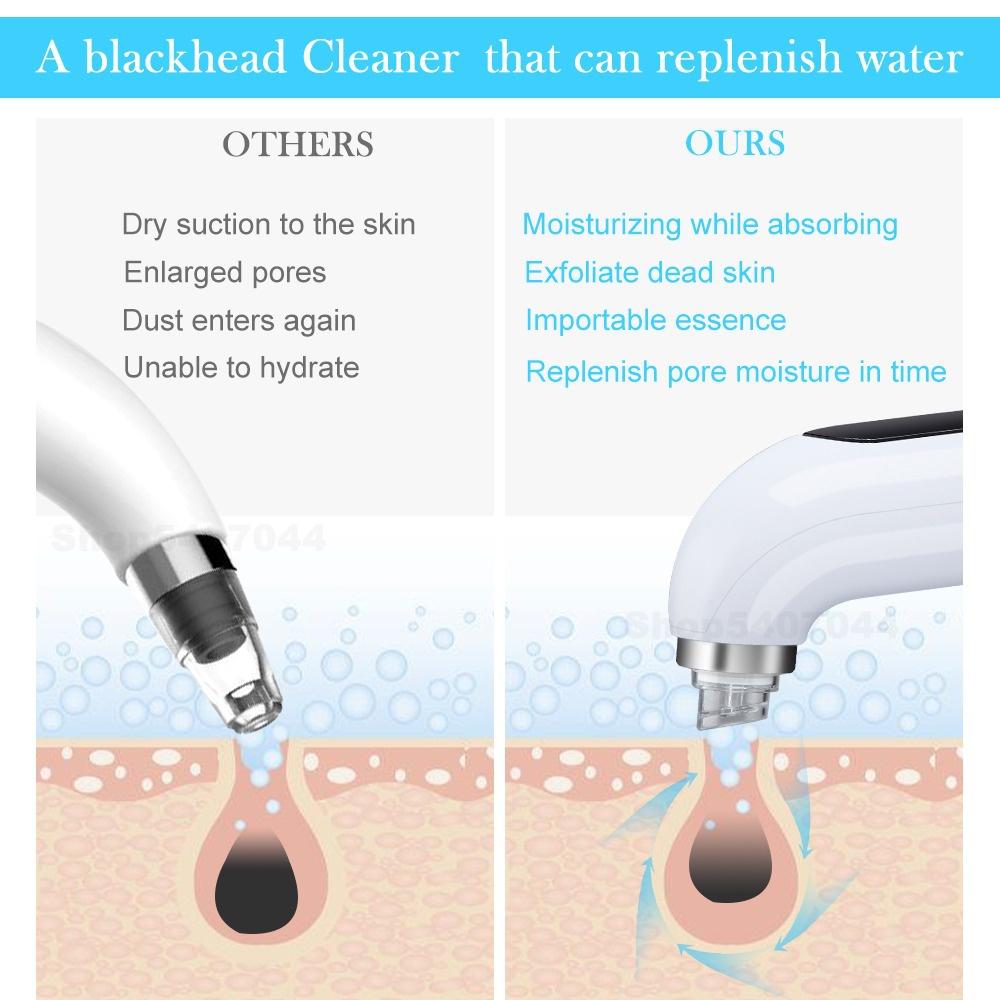 Hydro Blackhead Cleaner. Your HydraFacial at Home!