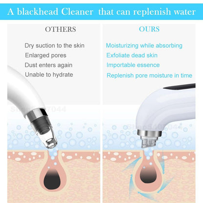 Hydro Blackhead Cleaner. Your HydraFacial at Home!