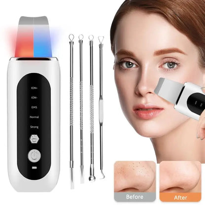 Ultrasonic Skin Scrubber