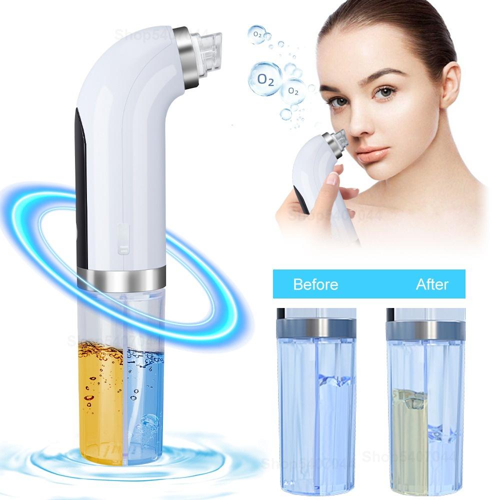 Hydro Blackhead Cleaner. Your HydraFacial at Home!